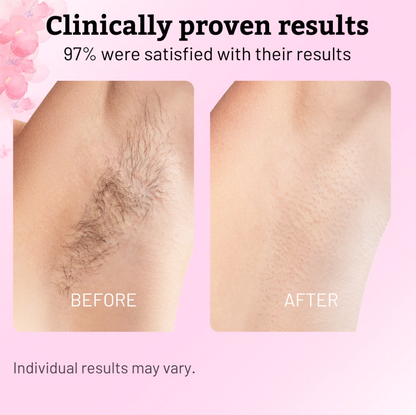 Cyperus Rotundus Oil for Natural Hair Reduction – 60ml | Smooth Skin Treatment for Slower Hair Regrowth